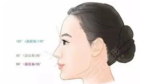 杭州任东医生鼻子整形案例介绍
