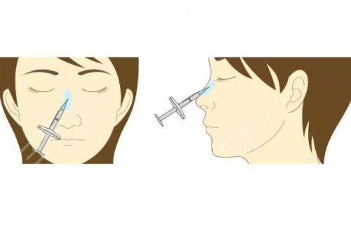 微创整形美容诊疗范围有哪些?