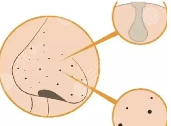 去黑头什么产品好用一点?真心好用的去黑头产品大合集!