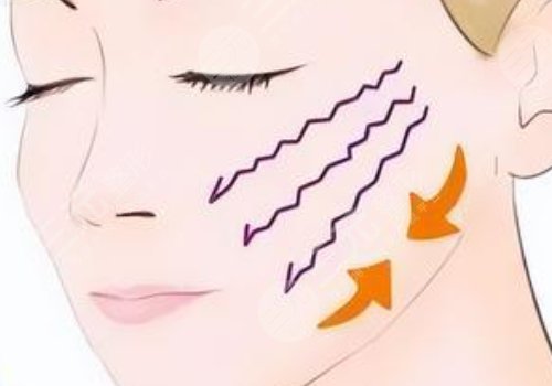 周旭刚院长大拉皮怎么样?