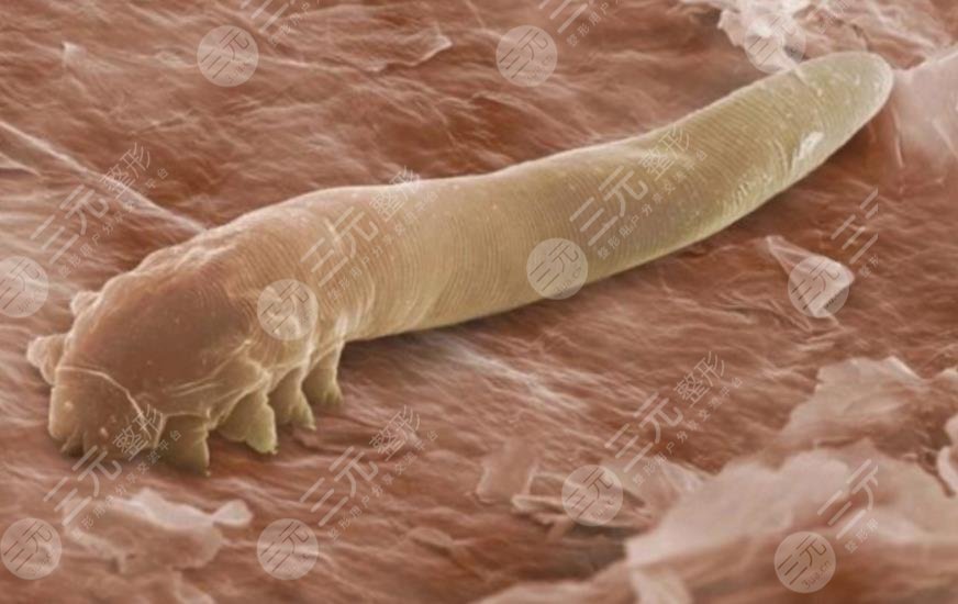 螨虫感染皮肤的症状