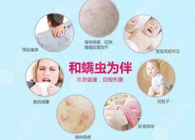 螨虫感染皮肤的症状