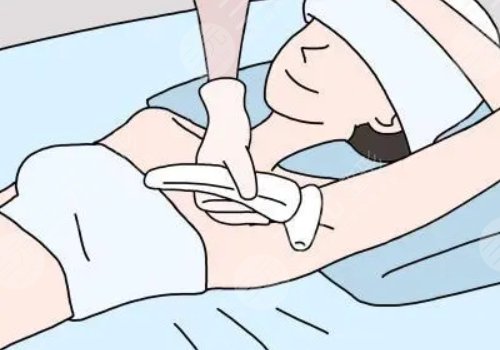 激光脱毛和冰点脱毛哪个好？