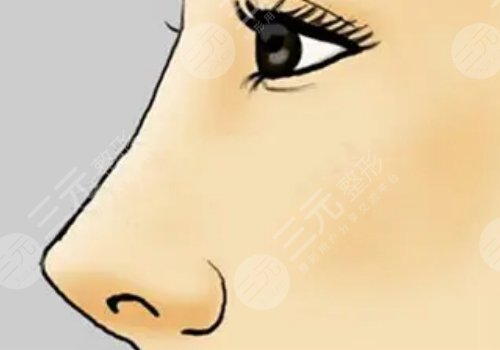 美国菲斯挺膨体适合放在鼻子哪里?