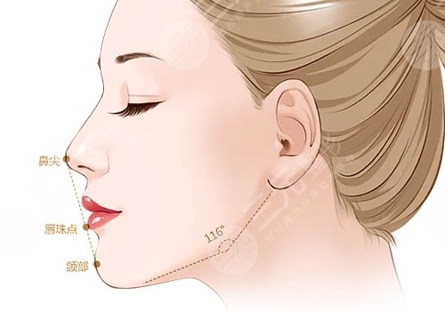 美国菲斯挺膨体适合放在鼻子哪里?