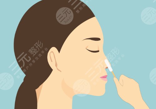 打玻尿酸隆鼻子有副作用吗？