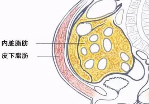德国水动力吸脂怎么样?