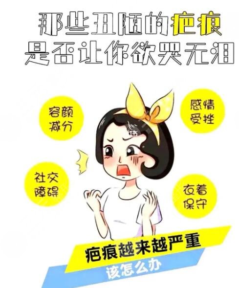 点痣后留下的疤痕多久恢复?