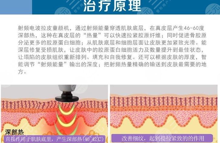 拉皮
