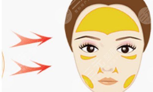 西安国际医学中心医院整形科孙峰怎么样？