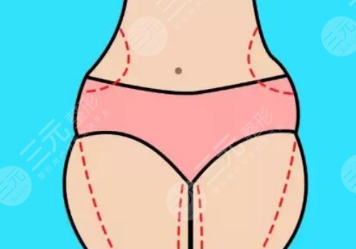 如何有效减肥不反弹？