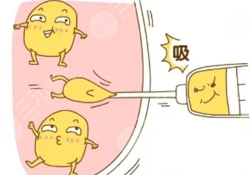 济南韩式和济南艺星哪个好?