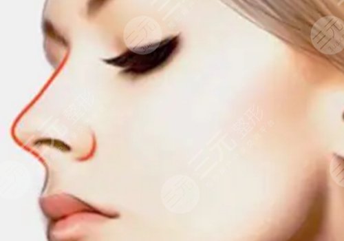 童列健和张武那个修复鼻子好