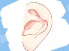 杯状耳是什么原因造成的？手术难度、佳年龄、注意事项