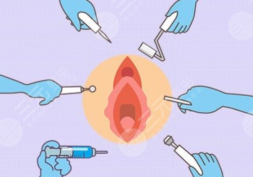 膜修复手术多少钱？