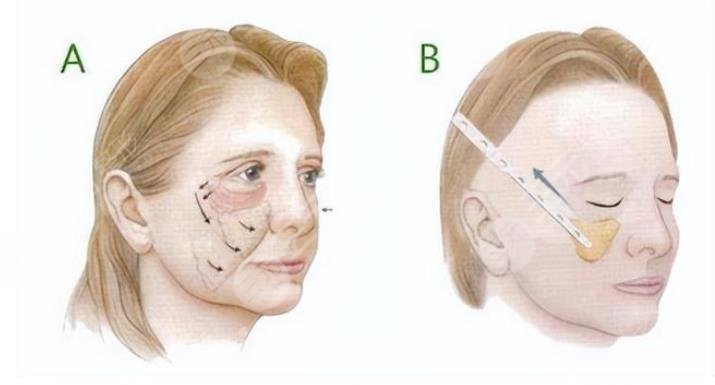 北京协和医院整形外科擅长项目