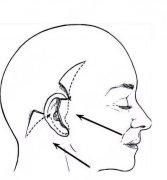 拉皮手术十年后的情况怎么样?拉皮和没拉皮有这些区别！