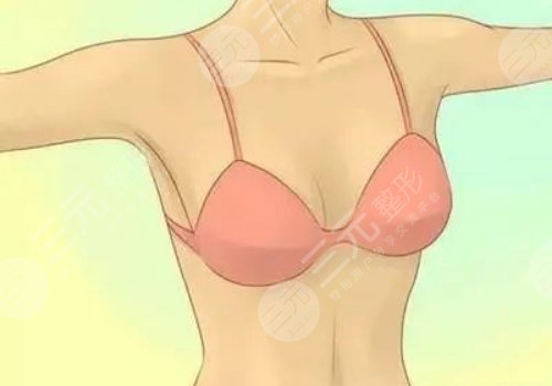 杭州李波隆胸怎么样