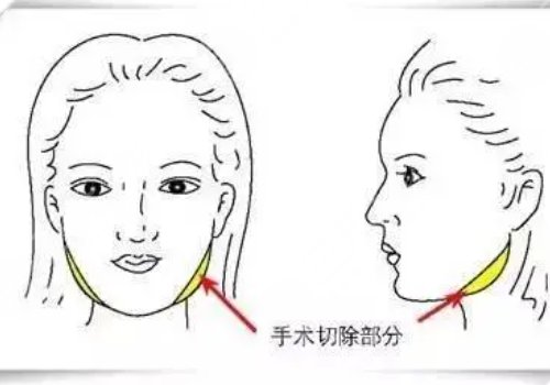 脸部外轮廓和内轮廓的位置