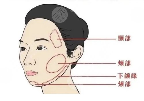 面部轮廓固定适合多大年龄