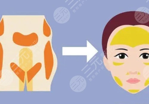 脸部填充用什么填充好？