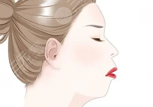 下颚线提升整形有什么做法？