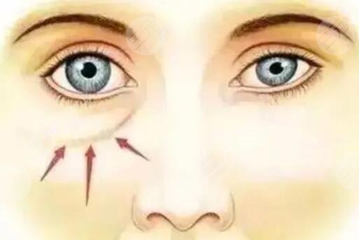 重庆毕胜医生擅长项目科普