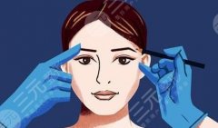 面部小拉皮手术的好处与坏处：了解一下帮助你进行变美参考！