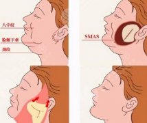 拉皮手术恢复期多少天？了解这些知识帮助快速恢复和防范并发症！