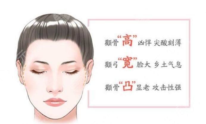 华西李继华颧骨内推做的怎么样？