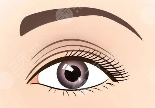 杨国正做双眼皮好还是许炎龙做的好