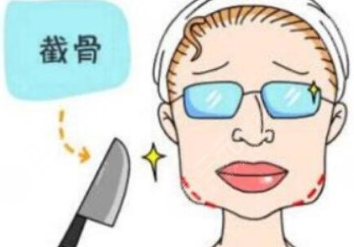 戴牙套可以做轮廓手术吗?