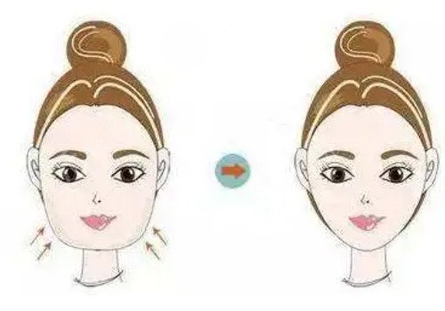 戴牙套可以做轮廓手术吗?
