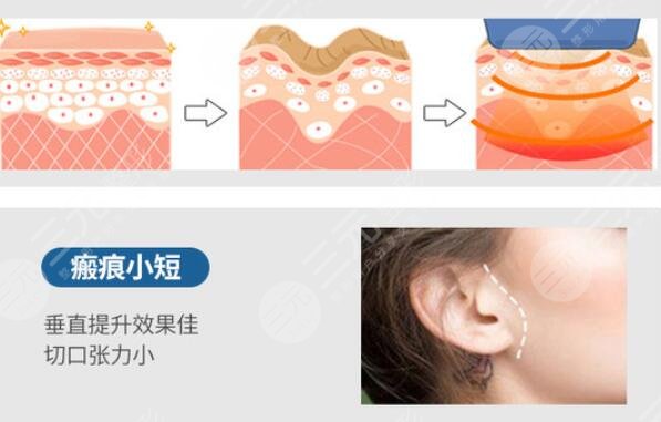 重庆美仑美奂杜亚旭医生擅长项目科普