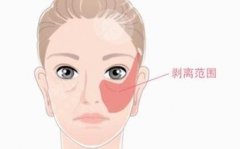 眼部拉皮手术一般多少钱？三个因素影响眼部拉皮手术的价格！