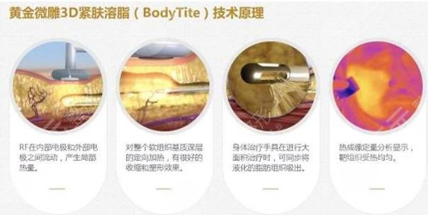 钻石微雕和黄金微雕区别