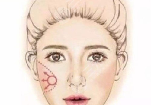 全脸轮廓固定能维持多久