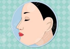 濡白天使隆鼻的风险?想要降低风险要注意这些事项! 濡白天使隆鼻的风险?想要降低风险要注意这些事项!