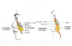 做一次大拉皮要多少钱？原理|安全性|注意事项|效果科普！