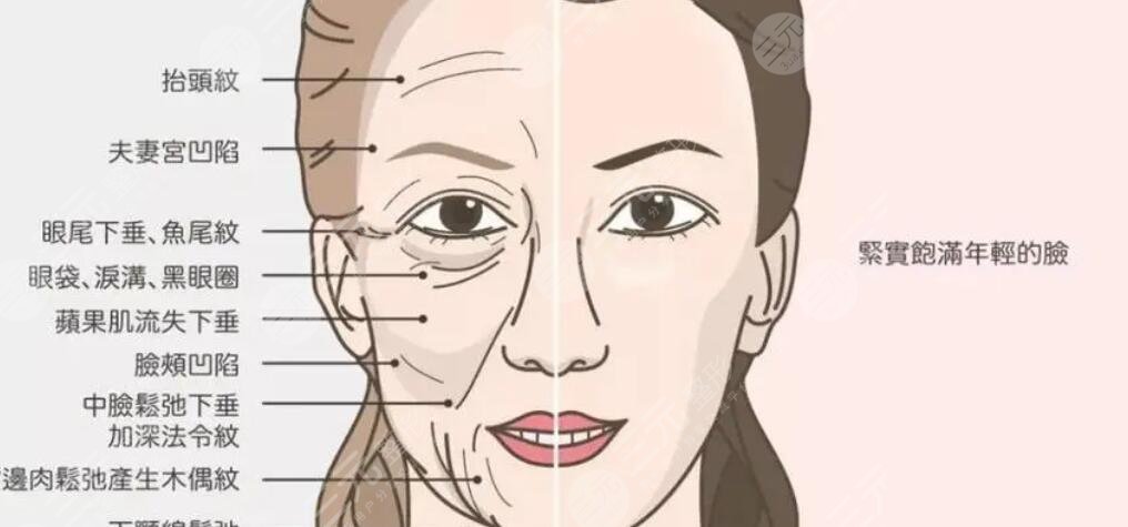 线雕