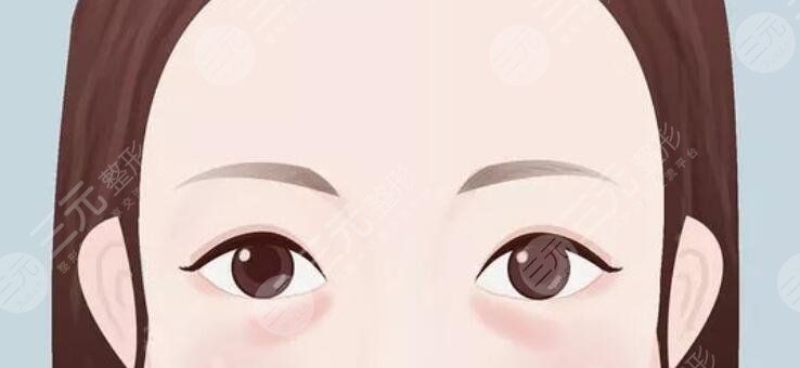 卧蚕