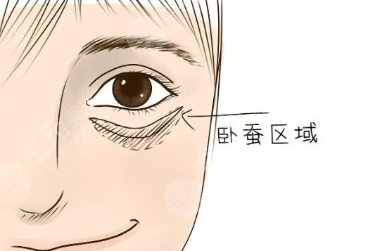 卧蚕