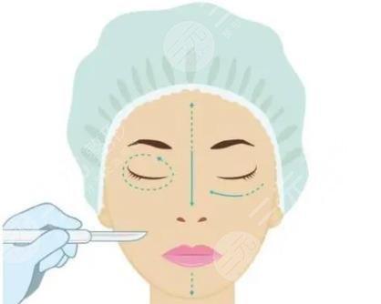 面部填充