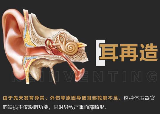 耳再造手术适宜年龄介绍！手术原理、注意事项，术前你需要了解这些！
