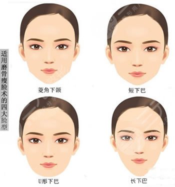 整容医院面部整容价格表