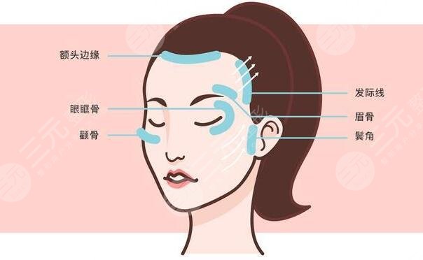 面部松弛下垂提升之后需要注意什么?