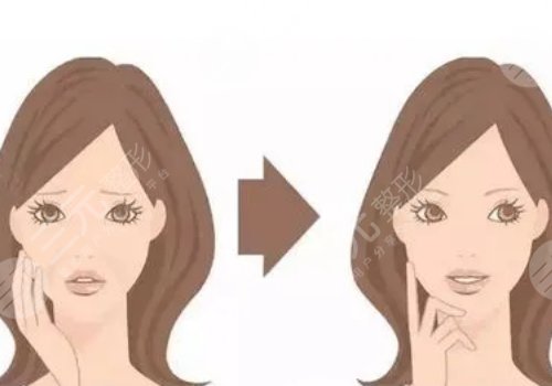 脸部下垂做超声刀好还是拉皮好呢？