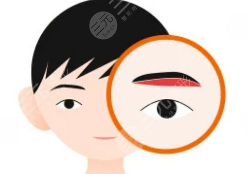 提眉的好处和坏处有什么？