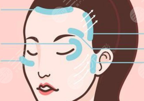 轮廓提升多久有效果？