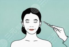 拉皮除皱价格是多少？影响因素、恢复期、护理知识分享！